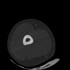 SPORK, NICO - 22.03.1976 - 02.08.2022 - CT obere Extremität - 17:51:17